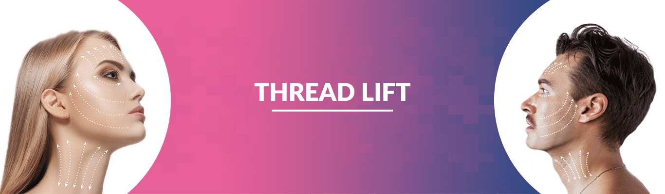 Thread-lift